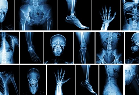 banner Radiographie