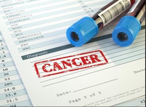banner Diagnostic du cancer